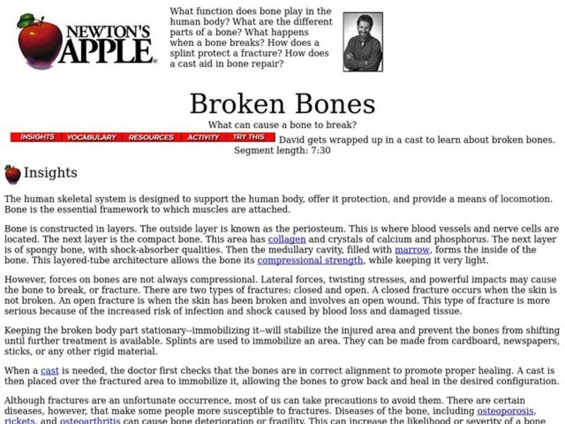 Broken Bones Lesson Plan