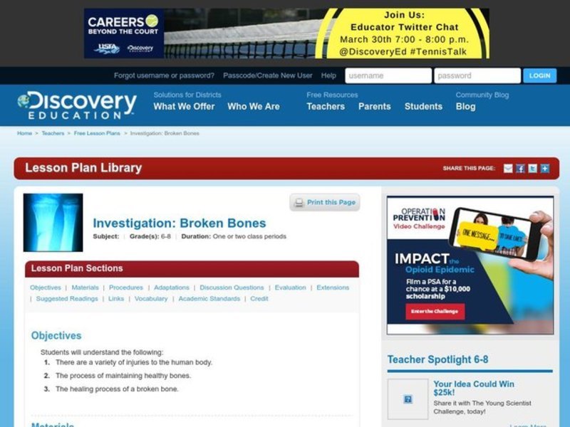 Broken Bones Lesson Plan