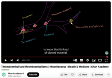 Thromboemboli and Thromboembolisms Instructional Video