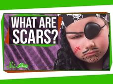 What are Scars? Instructional Video