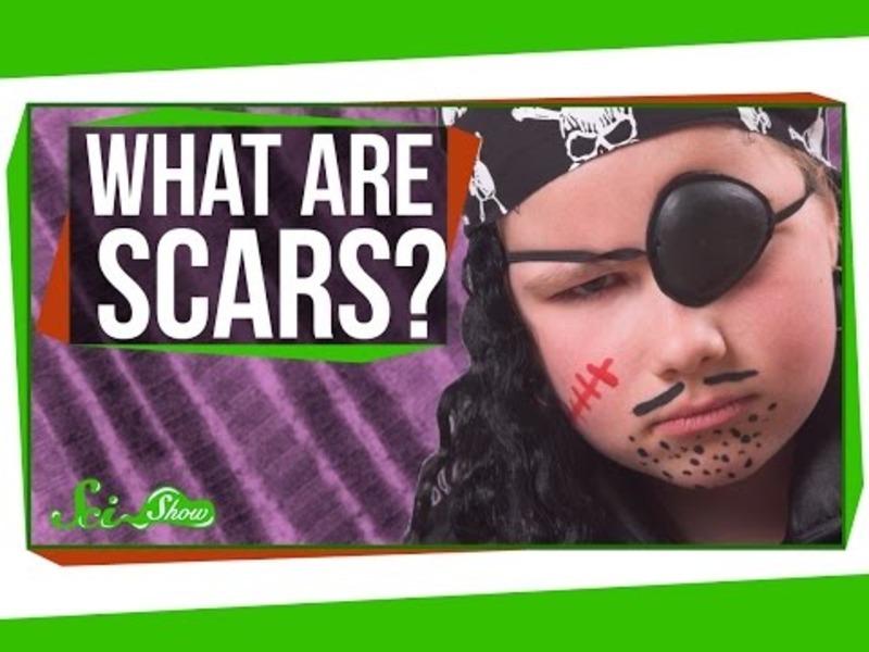 What are Scars? Instructional Video