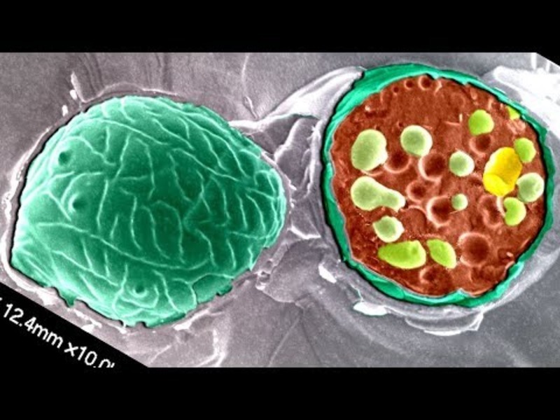 The Fungus on Your Head Instructional Video