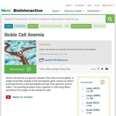 Sickle Cell Anemia Instructional Video