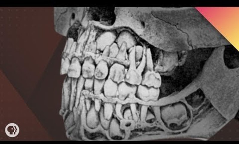 Where Do Teeth Come From? Instructional Video