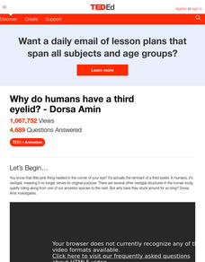 Why Do Humans Have a Third Eyelid? Instructional Video